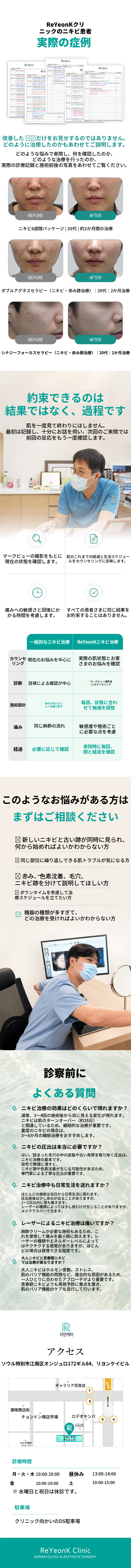 きれいな肌の始まり！ニキビケア
