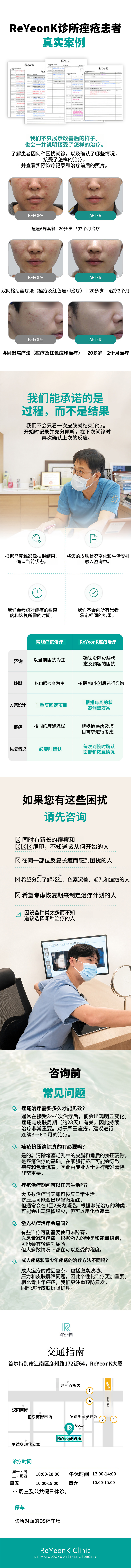洁净肌肤的开始！痤疮护理