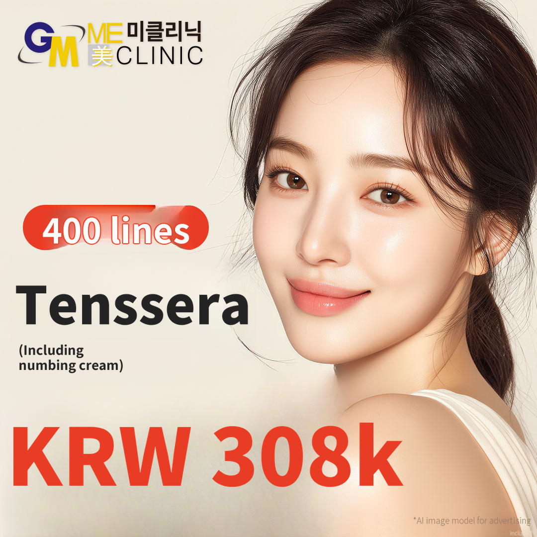 Tenssera Lifting – 400 Lines