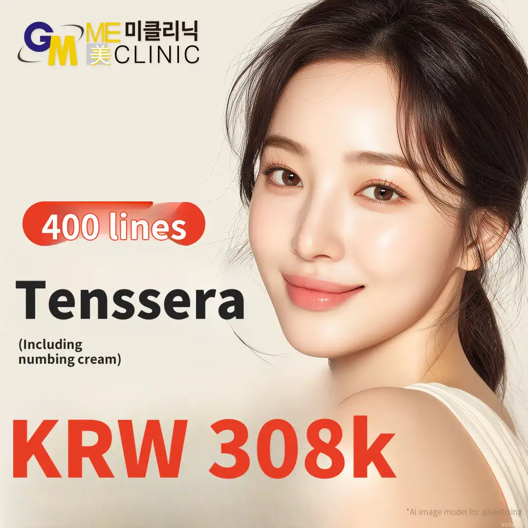 Tenssera Lifting – 400 Lines