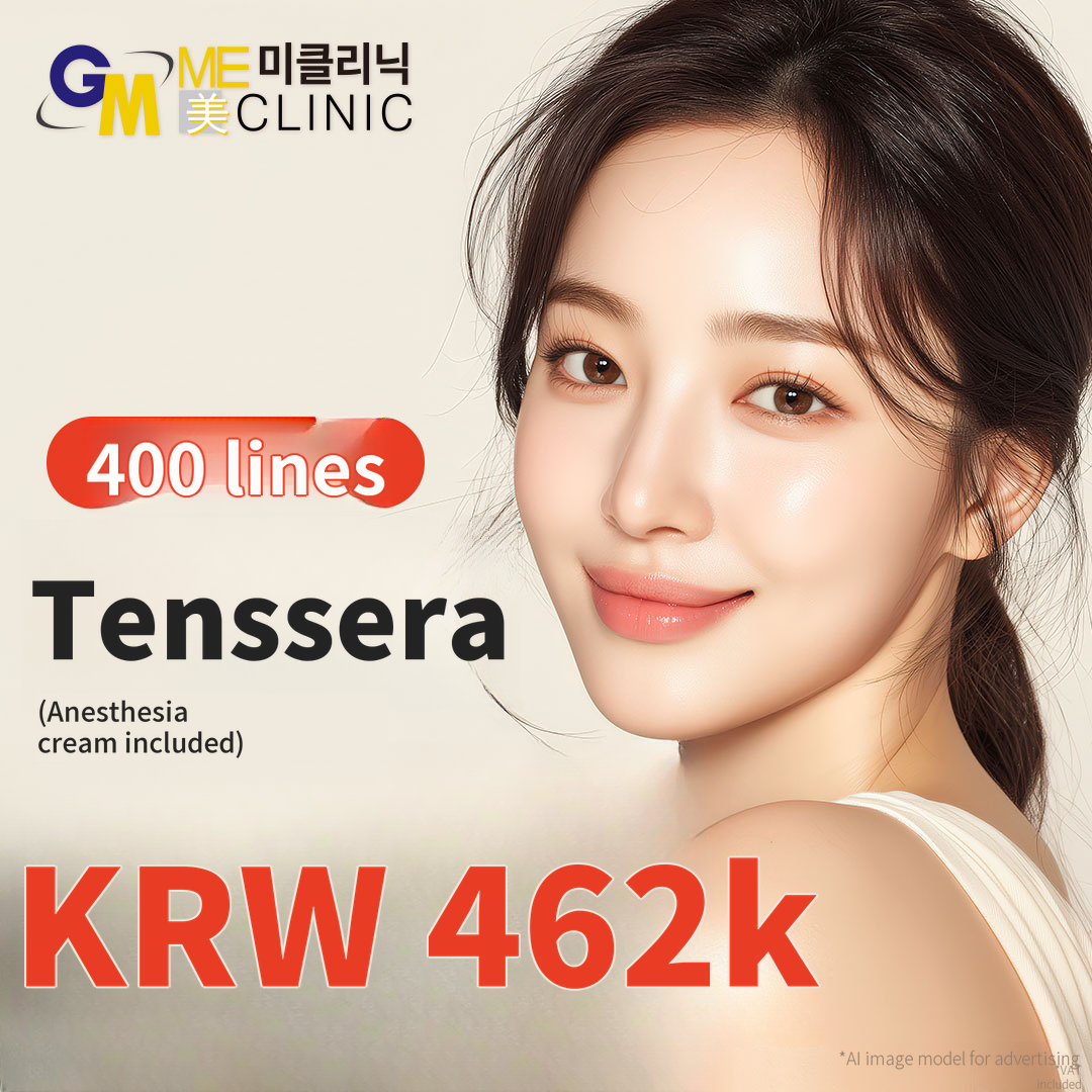 Tenssera Lifting – 600 Lines