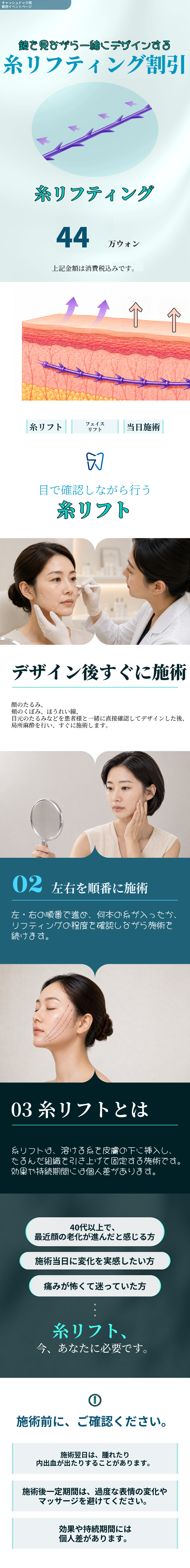 糸リフト