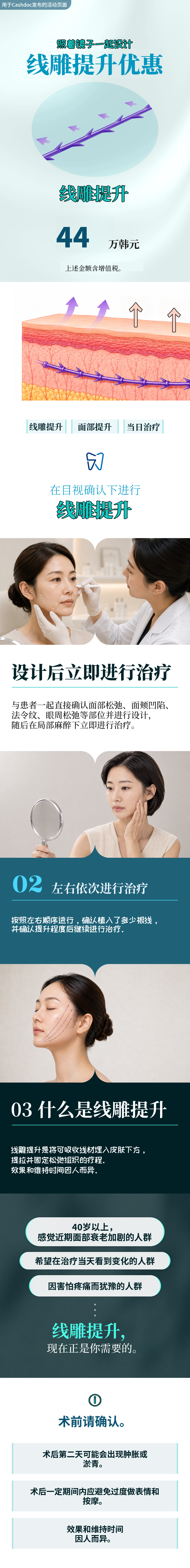埋线提升
