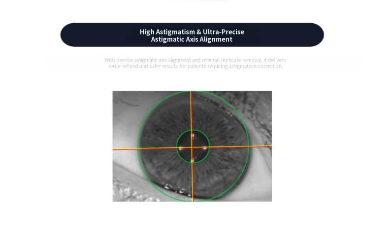 Clear Supra LASIK