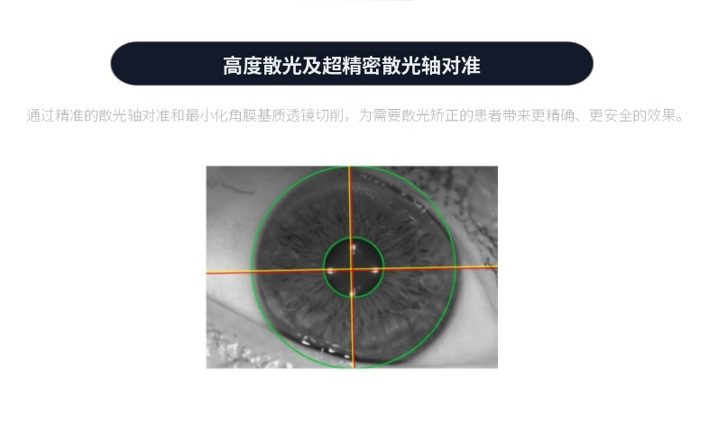清晰超视LASIK