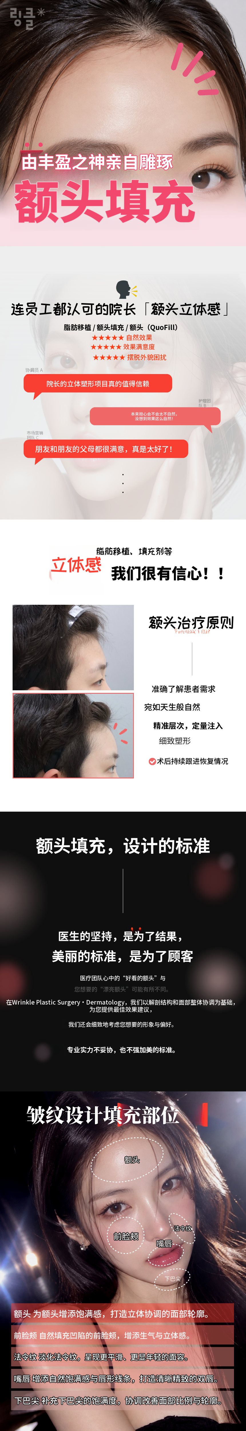 ♥丰盈之神♥ 设计款玻尿酸丰额 1cc