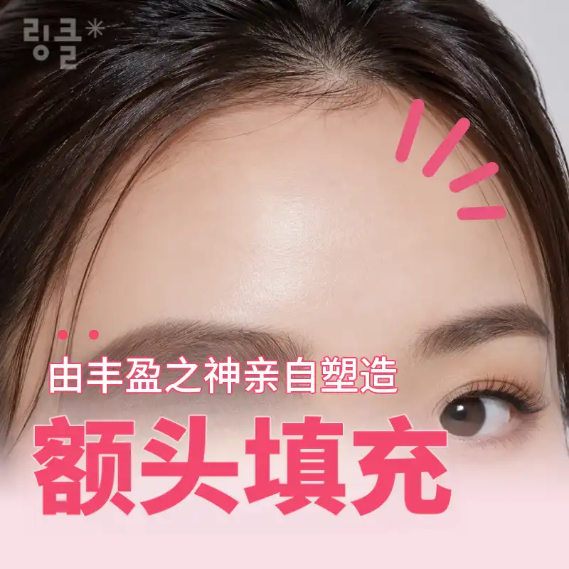 ♥丰盈之神♥ 设计款玻尿酸丰额 1cc