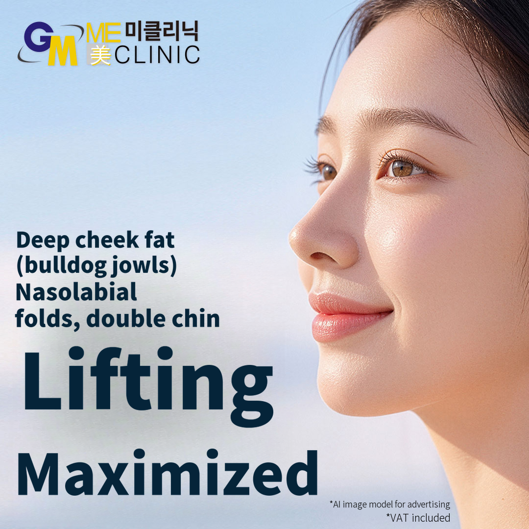 Special Trial Offer: Maximize Lifting for Deep Cheek Fat, Jowls, Nasolabial Folds, and Double Chin