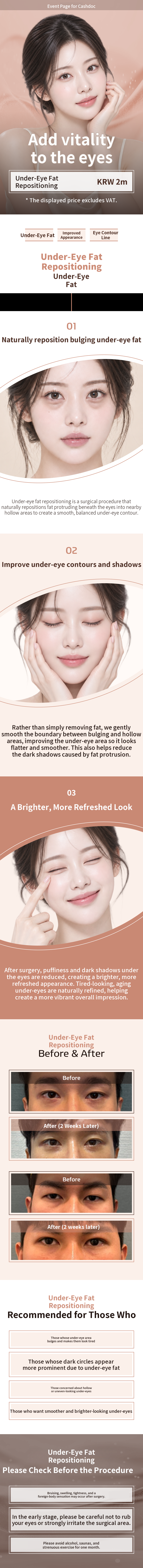 Surgery performed directly by the chief surgeon) Add vitality to the eyes with Under-Eye Fat Repositioning