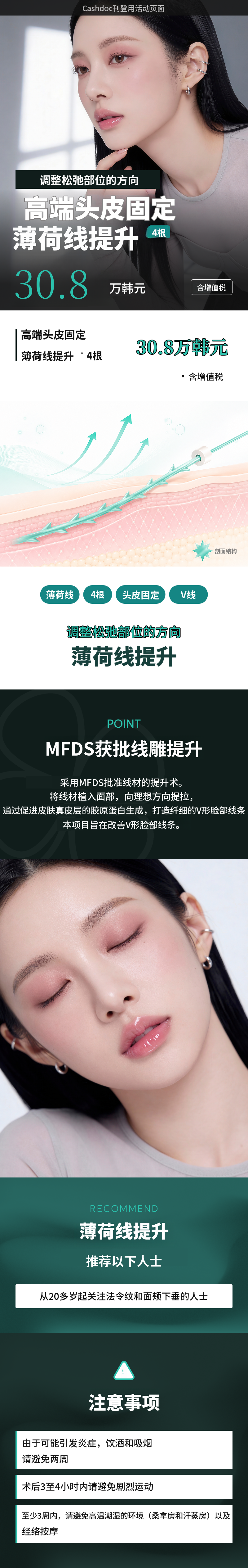 UP♥针对法令纹、深层颊部松弛的高端头皮固定式MINT埋线提升