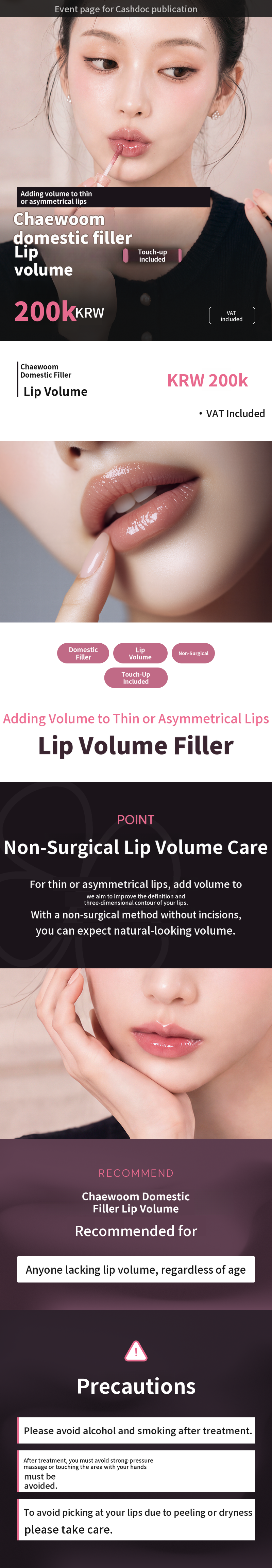 UP♥ If Your Lips Are Thin and Asymmetrical, Volumizing Lip Filler (Including Touch-Up)