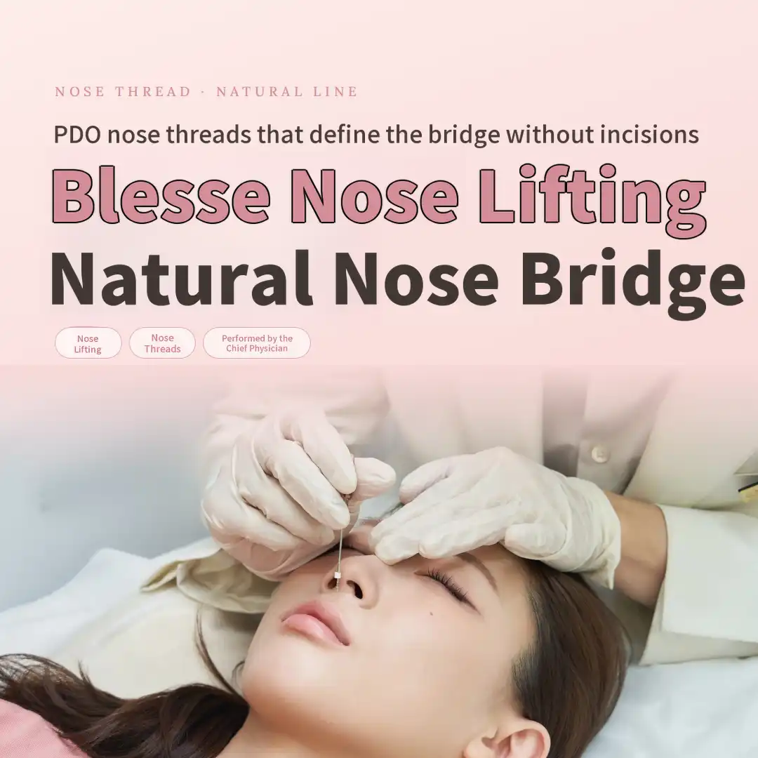 Beautiple Nose Lift, a Natural Nasal Bridge Thread Lift That Surpasses Hi-Co