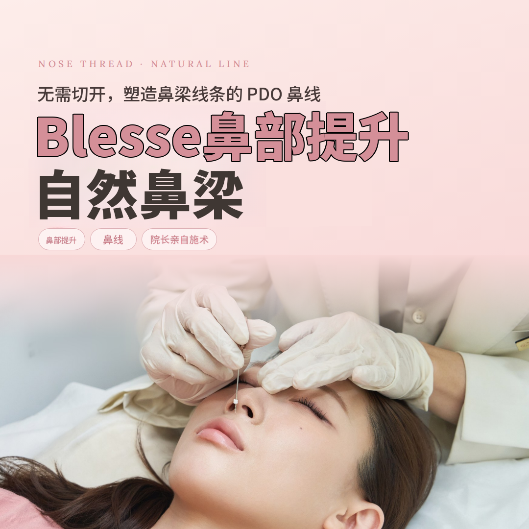 布里普尔鼻部提升,超越嗨鼻的自然鼻梁埋线