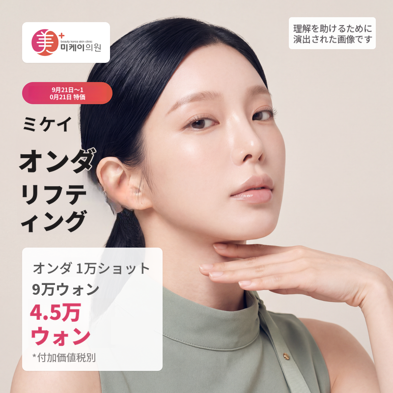 ミケイ オンダリフト 1万ライン