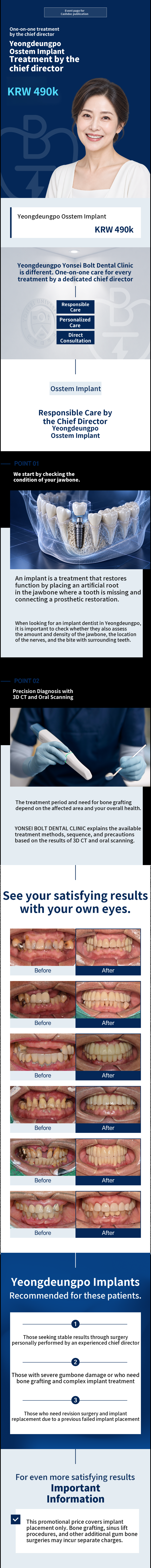 Yeongdeungpo Station Dental Implants (Treated by the Chief Dentist)