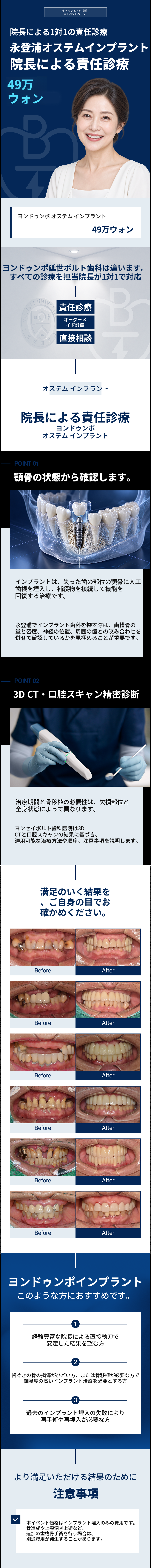 永登浦駅インプラント（代表院長が担当）