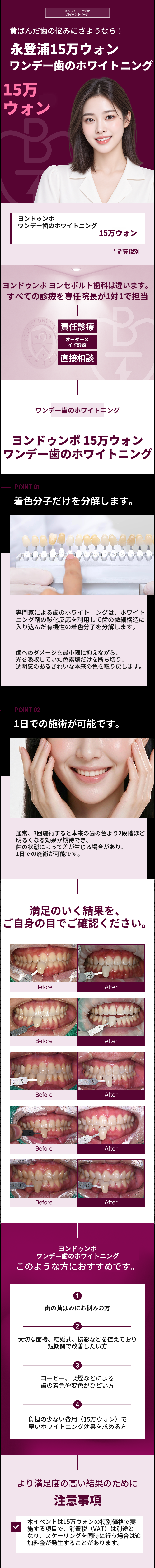 1日で黄ばんだ歯を卒業！ワンデー歯のホワイトニング3回
