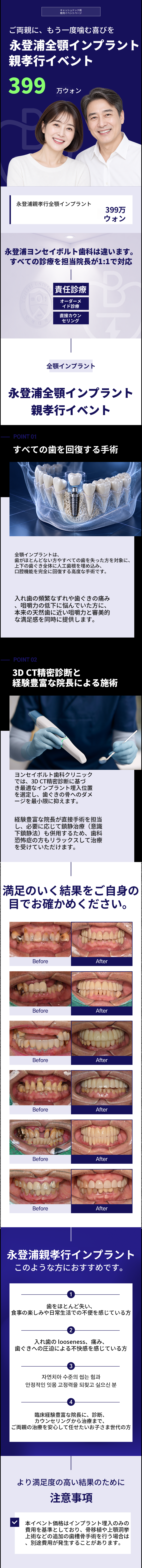 全顎インプラント、代表院長によるカウンセリングからアフターケアまで