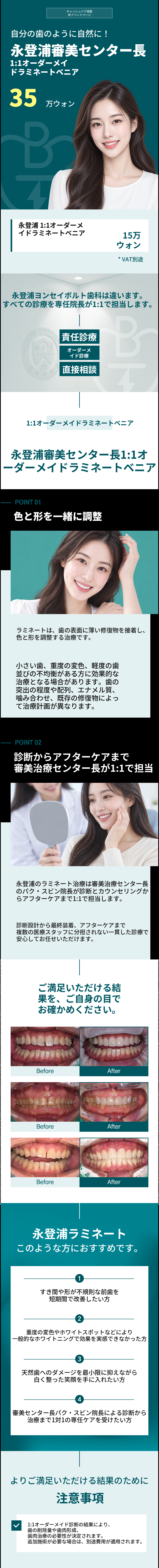 審美センター長による1対1のオーダーメイドラミネートベニア