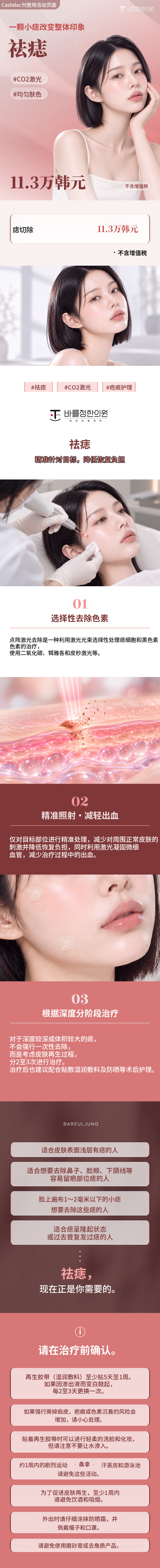CO2铒雅各激光祛痣及肤色调理