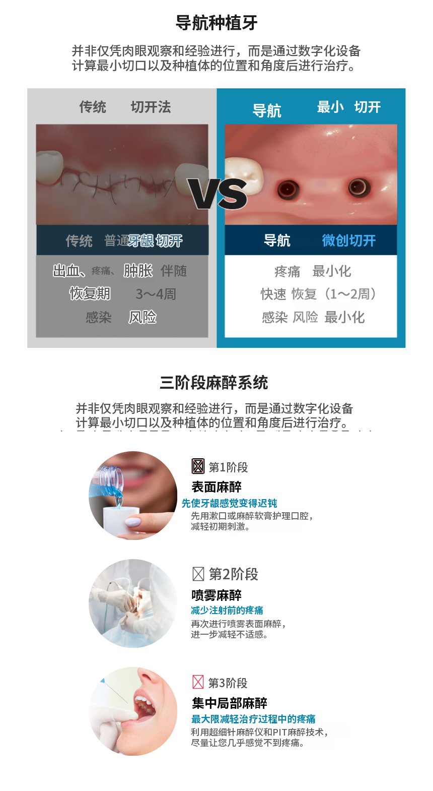 国产正品奥齿泰种植牙39万韩元💙