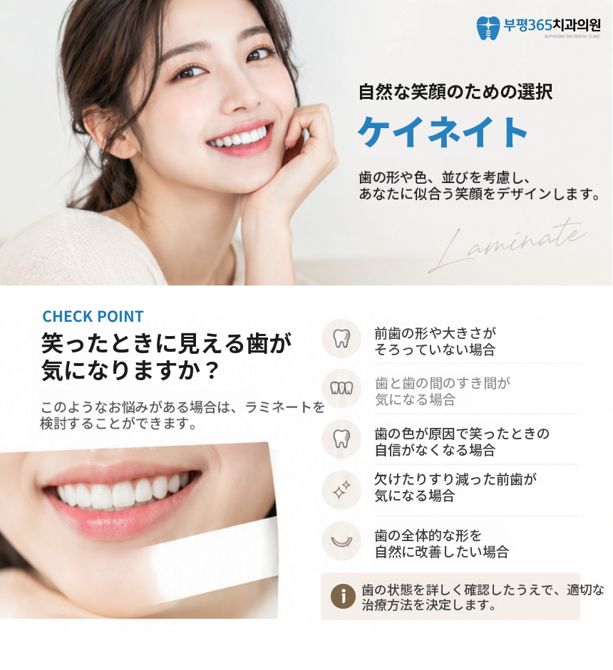 【院内技工所完備】無削合Kラミネートベニア💙