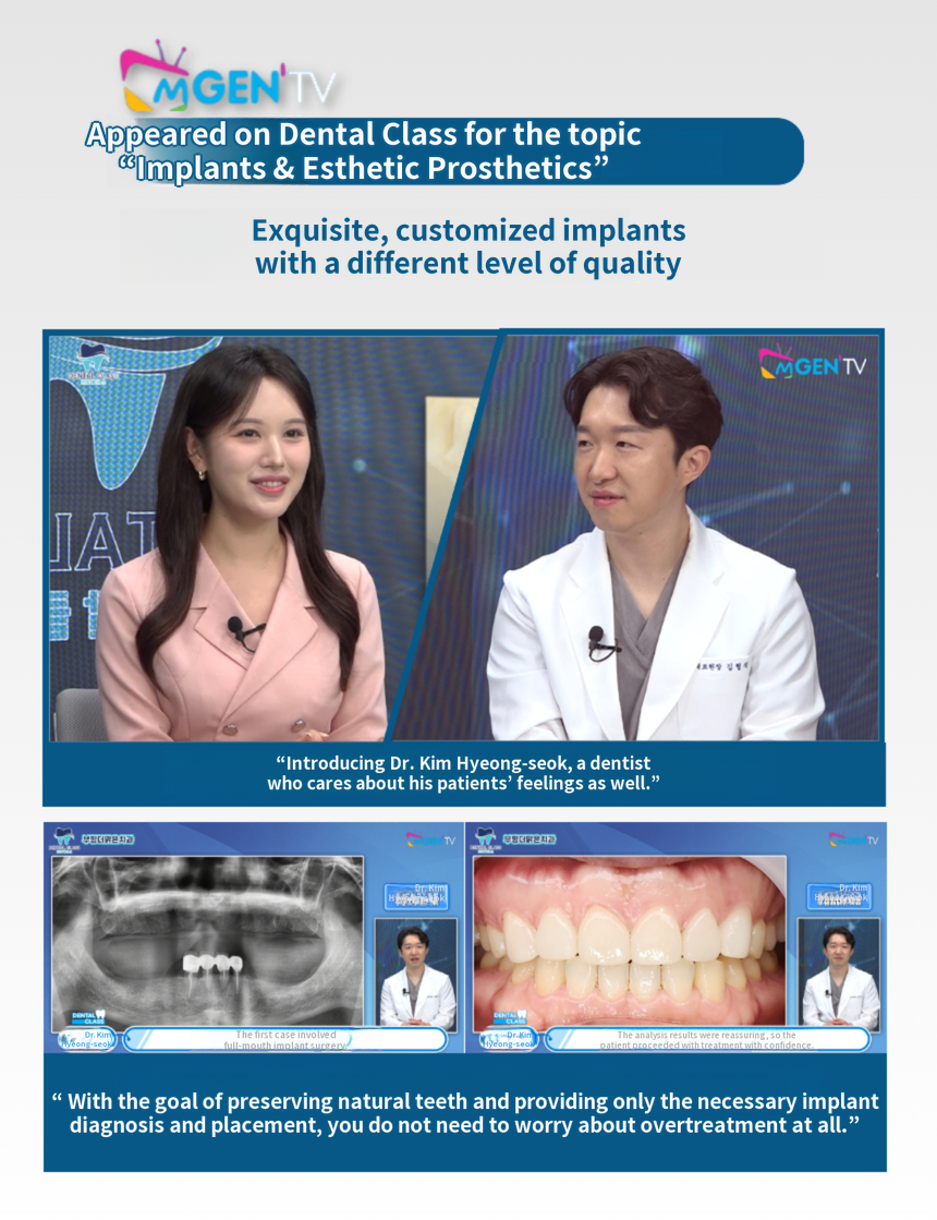[In-house Dental Laboratory] No-Prep K Dental Veneers💙