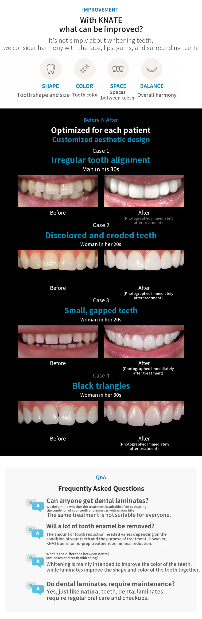 [In-house Dental Laboratory] No-Prep K Dental Veneers💙