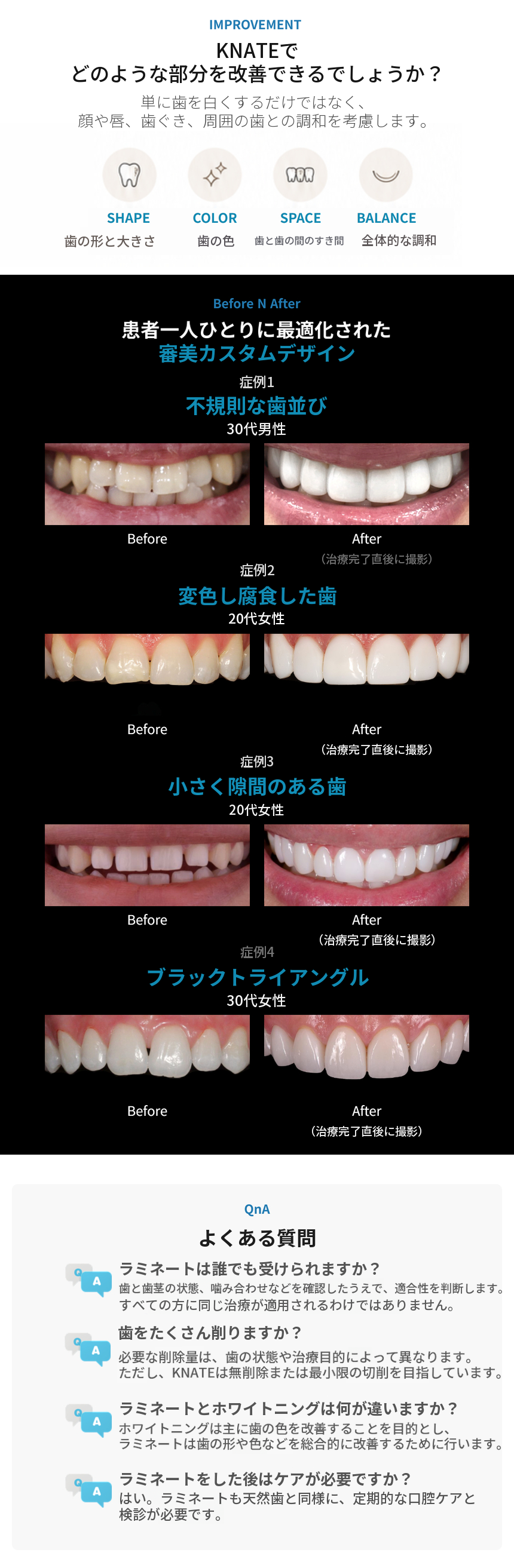 【院内技工所完備】無削合Kラミネートベニア💙