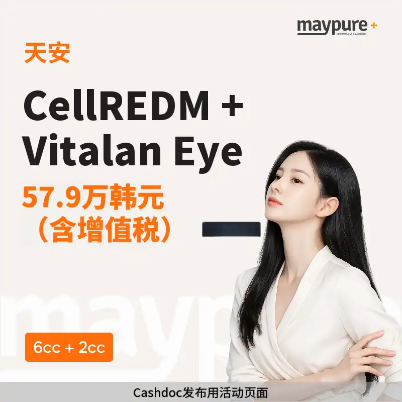 [天安] 塞尔迪艾姆 + 维塔兰眼