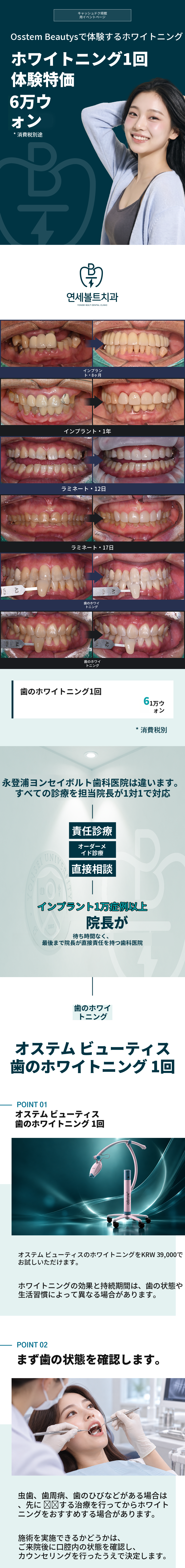 オステム歯科ホワイトニング1回券