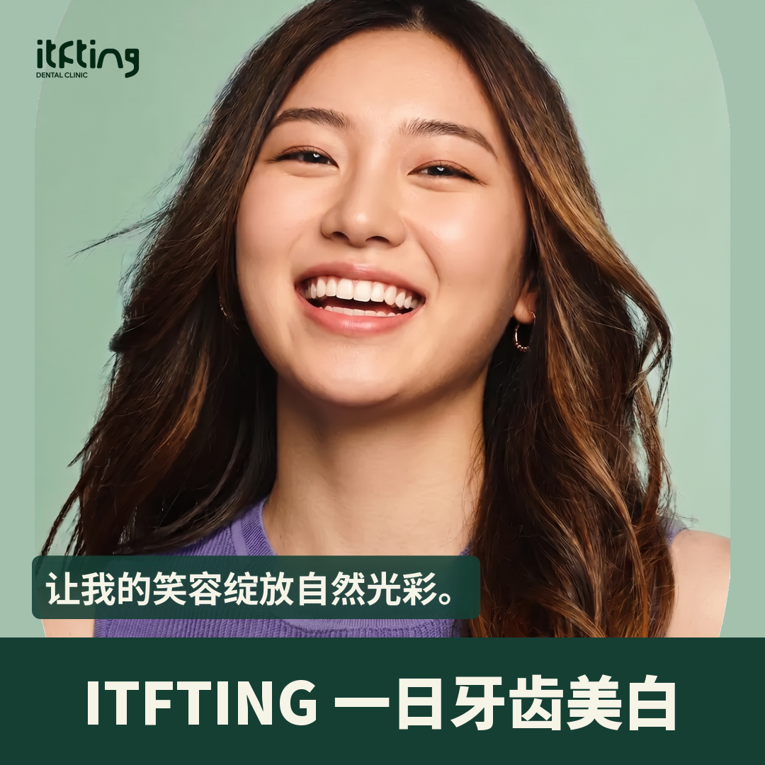 Beautis正品1DAY牙齿美白