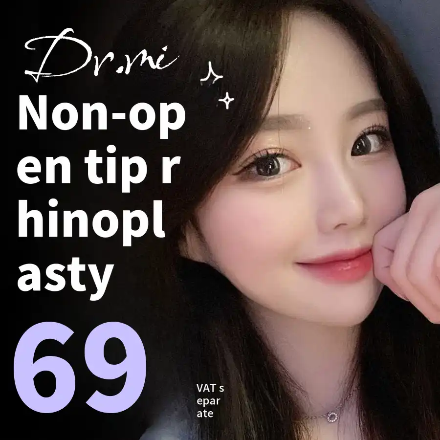 Nose Beam Non-Exposure Tip Rhinoplasty