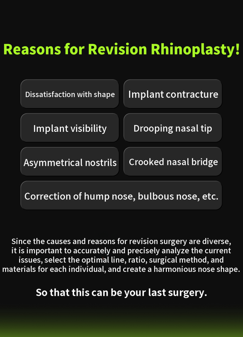 ❤️View❤️ Nose Revision Surgery