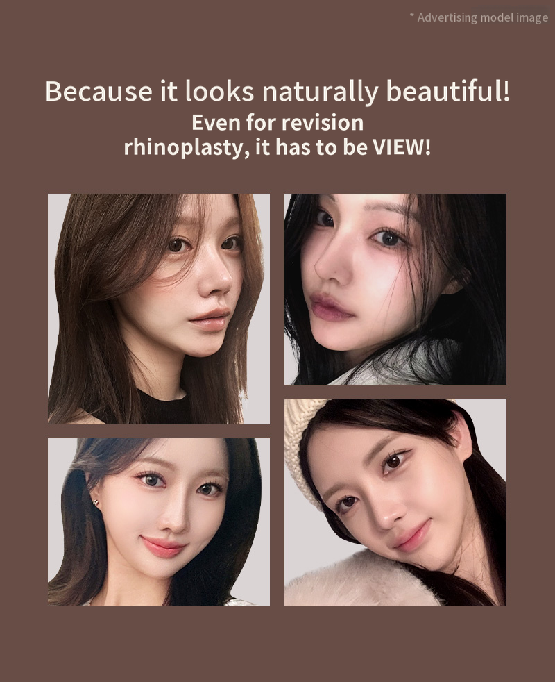 ❤️View❤️ Revision Rhinoplasty