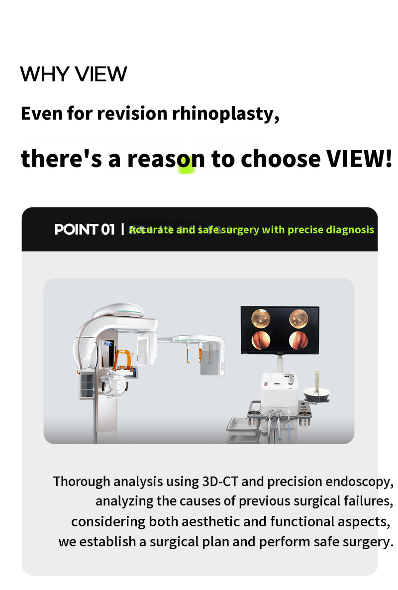 ❤️View❤️ Nose Revision Surgery
