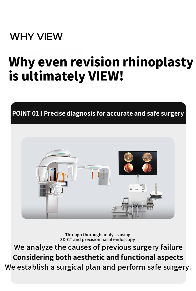 ❤️View❤️Rhinoplasty