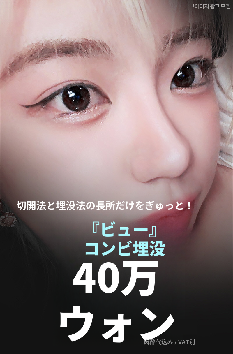 ❤️ビュー❤️目の整形