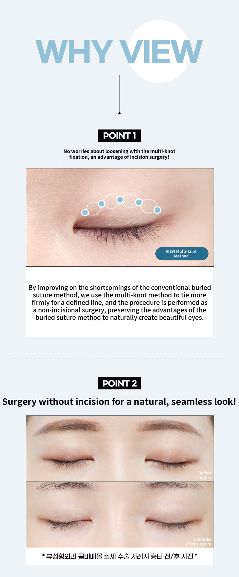 ❤️View❤️Eye Surgery