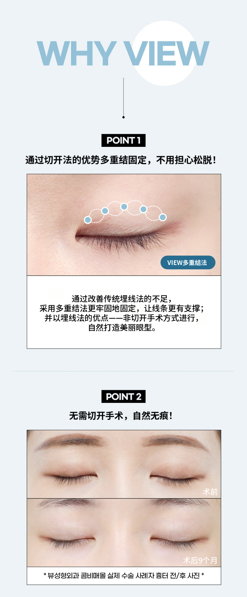 ❤️视❤️眼部整形