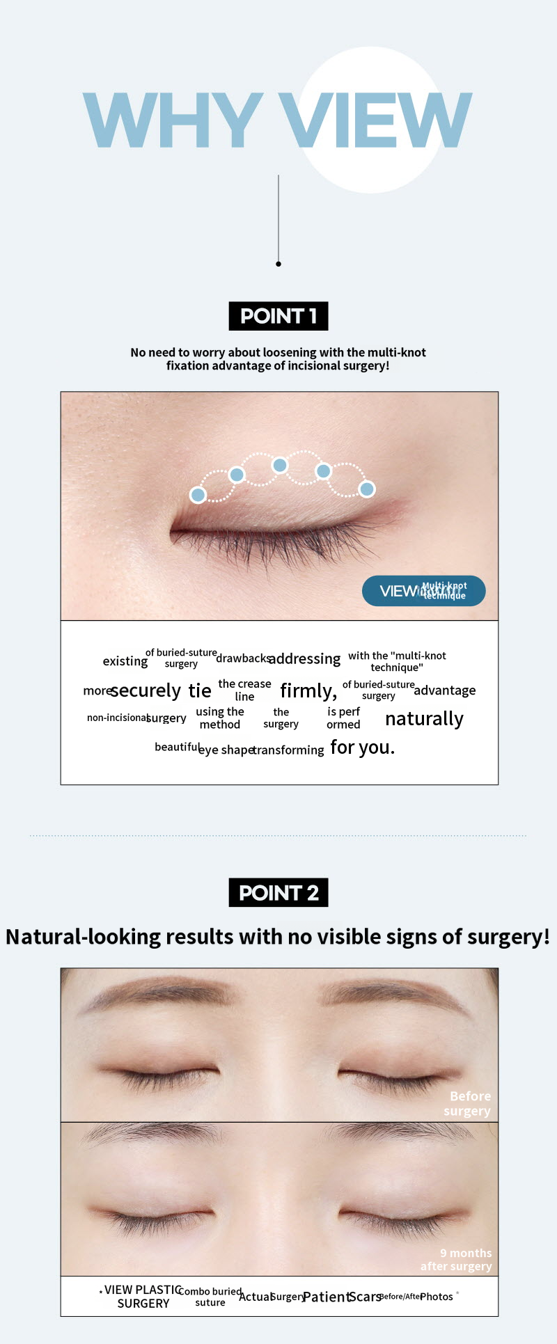 ❤️VIEW❤️ Eye Surgery