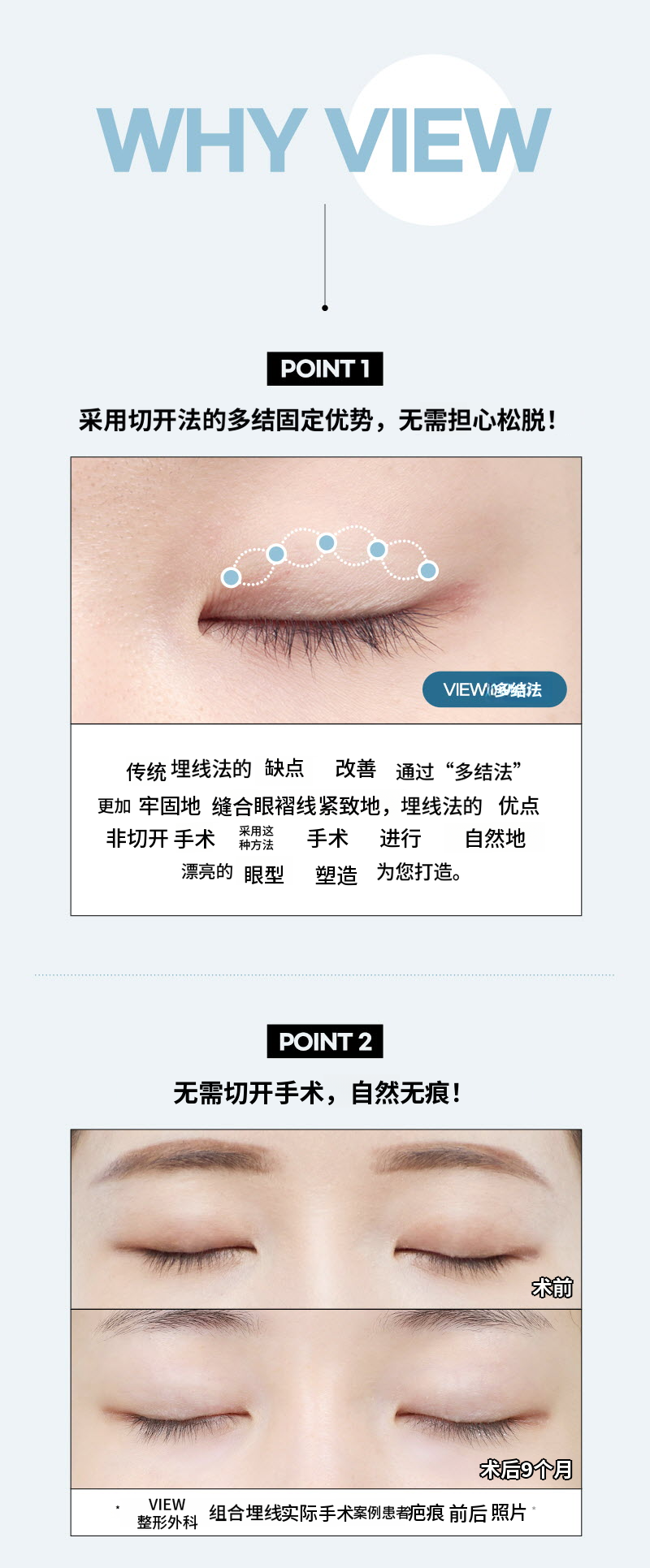 ❤️View❤️眼部整形