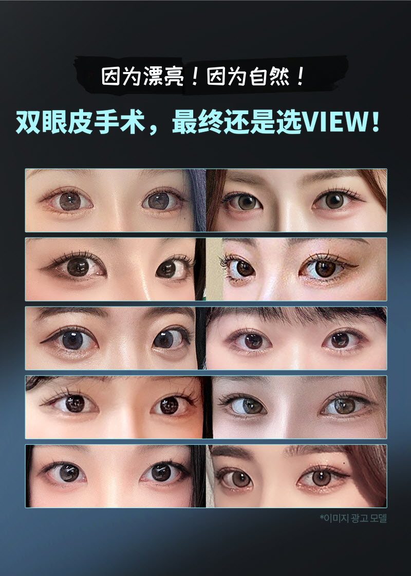 ❤️美丽❤️眼睛整形