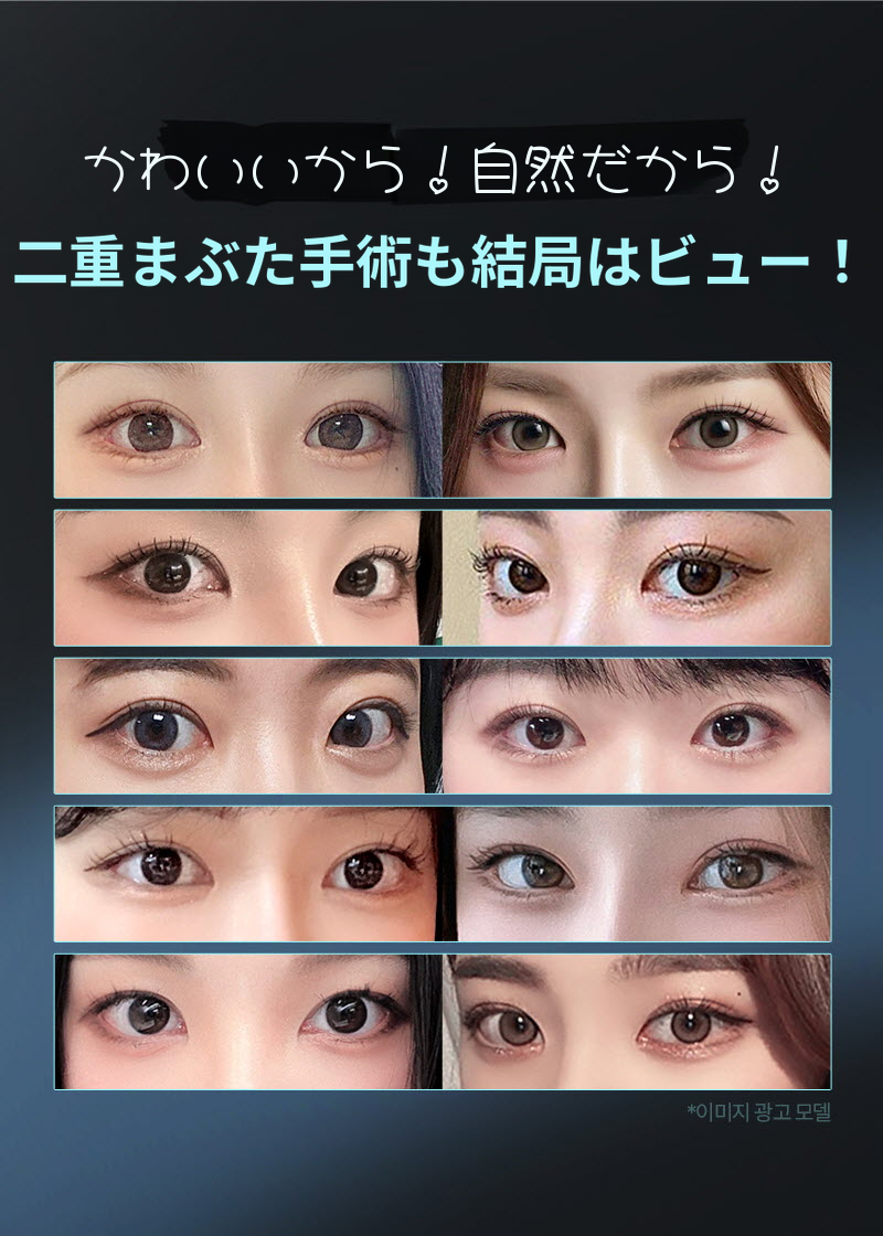 ❤️ビュー❤️目の整形