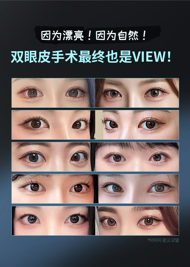❤️视❤️眼部整形