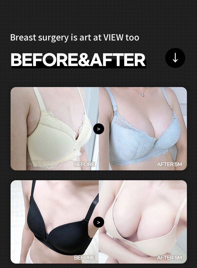 ❤️View❤️UIU Breast Surgery 240