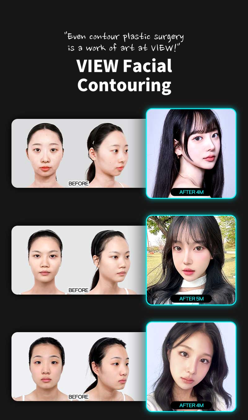 ❤️View❤️Facial Contouring