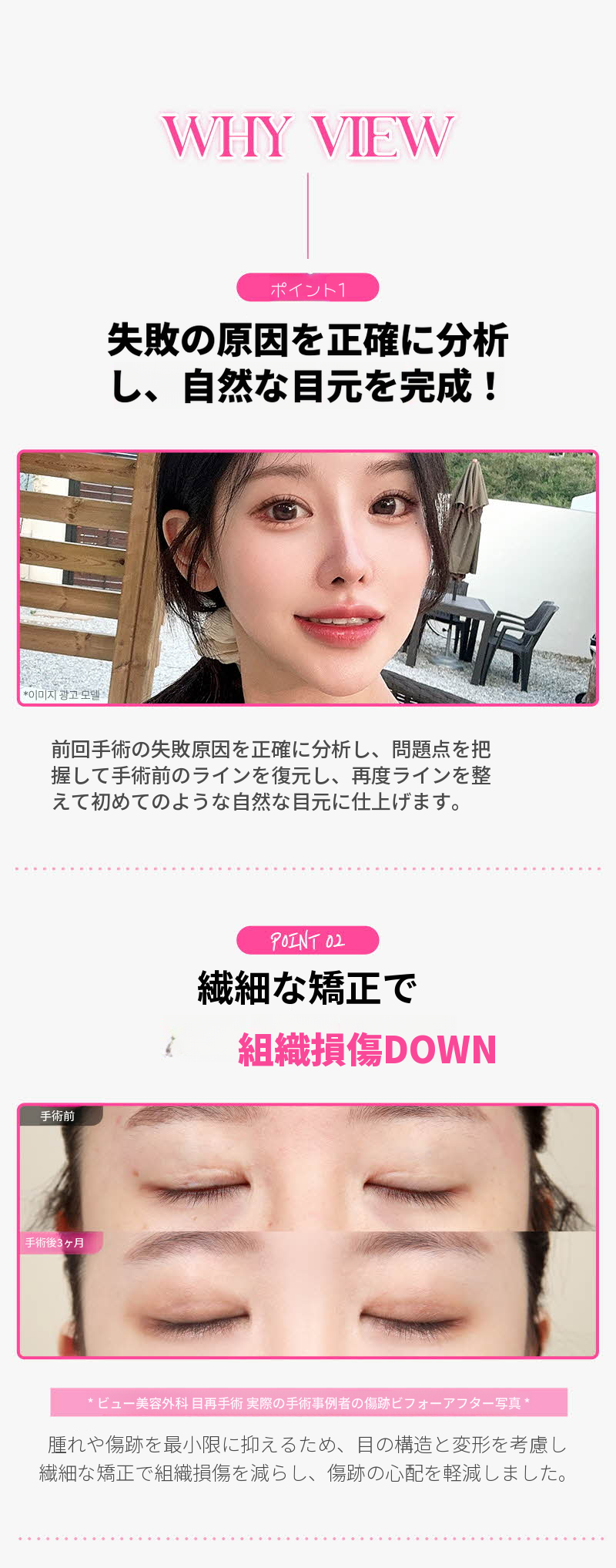 ❤️ビュ❤️目の再手術