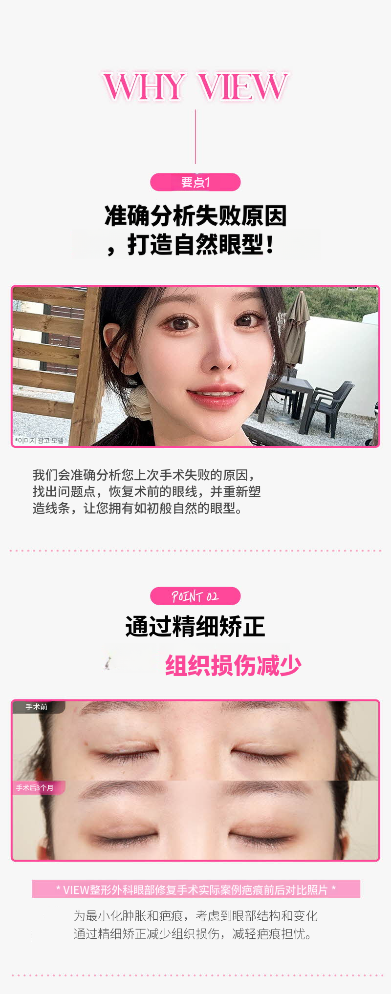 ❤️美丽❤️眼睛重建手术
