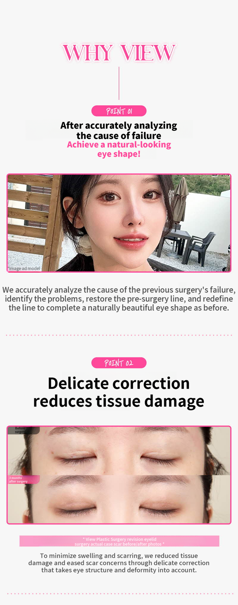 ❤️View❤️Eye Reoperation